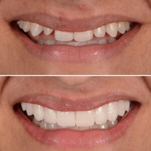 trial smile